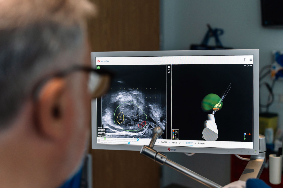 Dr. Barkin performing an MRI Fusion Biopsy